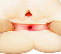 �����Υ������ʤϥҥ���¤���鿼���ϥ��ܹ�¤��