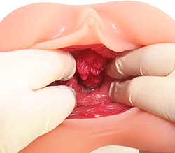 ��ʳ����G���ݥåȤǥӥå��ʥ��ĥ��Ĥ��С�